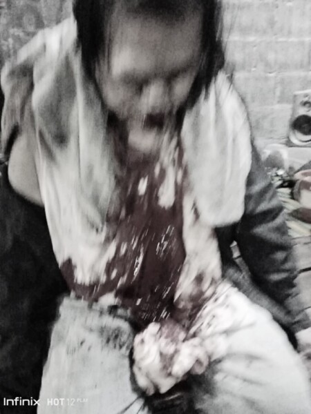 ศรีสะเกษเดือด! ชาวบ้านร้อง ผู้การศรีสะเกษ ถูกทำร้ายเลือดอาบหน้า – คดีไม่คืบ ขอผู้การฯ เร่งคืนความเป็นธรรม อย่ารับเคลียร์